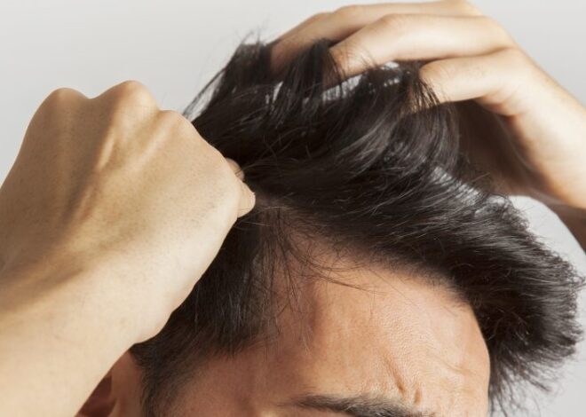 Queda de Cabelo Masculino: Entenda as Causas e Como Tratar