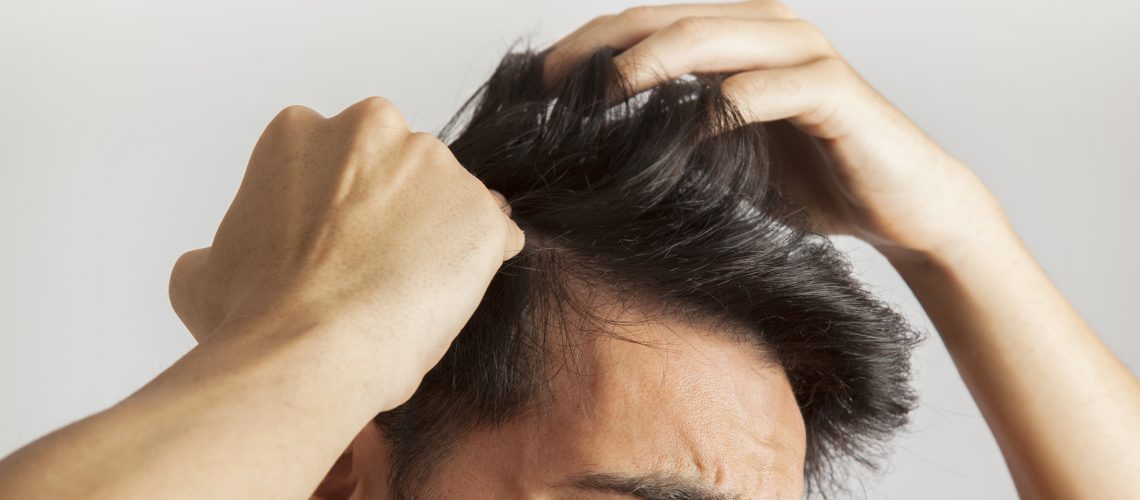 Queda de Cabelo Masculino: Entenda as Causas e Como Tratar